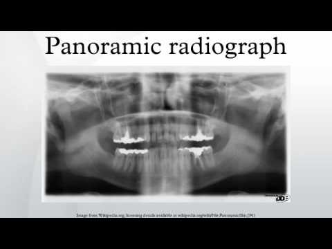 Panoramic radiograph - YouTube