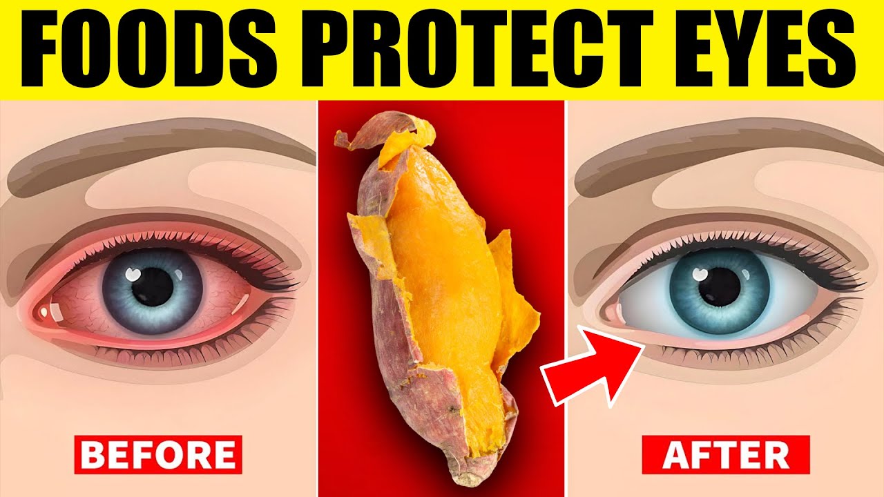 Eye Protection Food 7 Foods That Protect Your Eyes and Optimize Your Vision - YouTube