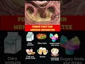 Sinusitis | Sinus Problems | Foods You Should Be Careful With  #shortsfeed