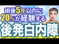 白内障手術をしたのにまた白内障!?後発白内障を徹底解説!