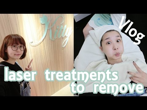 Vlog │跟著我一起去醫美 我的除斑皮秒雷射初體驗 laser treatments to remove