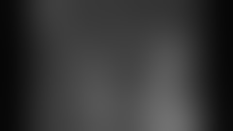 Robotic hepaticojejunostomy for anastomotic biliary stricture after liver transplantation | Narrated