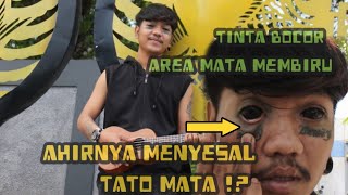 PENYESALAN ANAK PUNK GANTENG SETELAH DI TATO MATA ?!