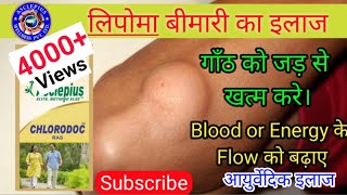 Lipoma | Ayurvedic Treatment | Chlorodoc