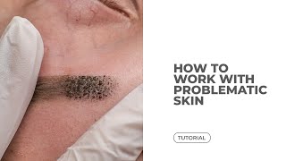 How To Work With Problematic Skin