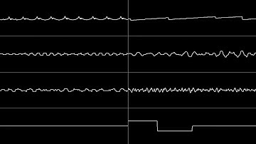 Delete that Bit [Delete This Tweet 8-bit remix]