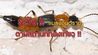 เตือนภัยหน้าหนาว โรคเชื้อรา อันตรายต่อผิวหนัง : พบหมอรามา ช่วง Big Story 12ธ.ค.59 (2/5)