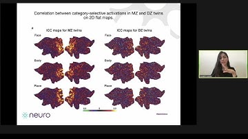 OHBM 2020 | Oral Sessions | Sensation & Perception