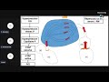 Rtrecissement mitral meilleure explication  par pr foudad ecn