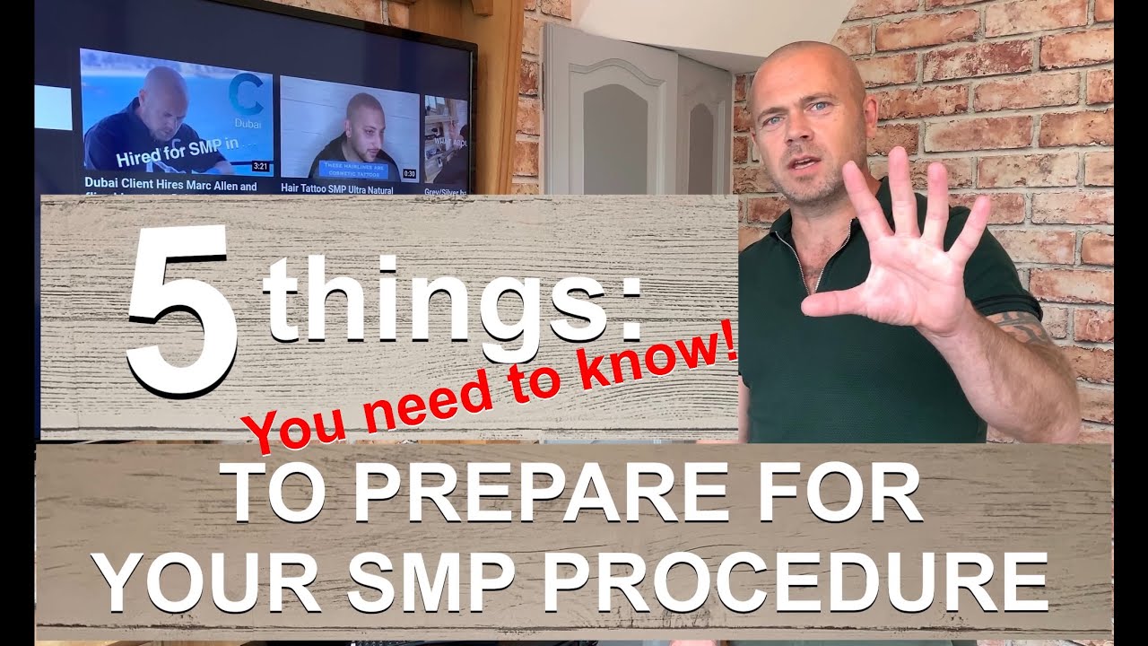 5 things to prepare for SMP hair Scalp MicroPigmentation - YouTube