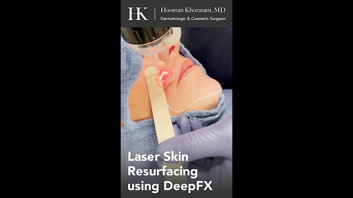 Wrinkle Reduction using DeepFX Laser Skin Resurfacing by Dr. Hooman Khorasani