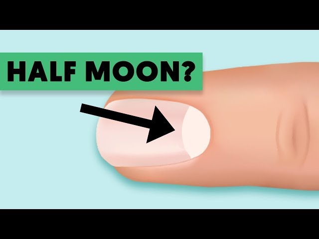 No half-moon on nails: What does it mean?