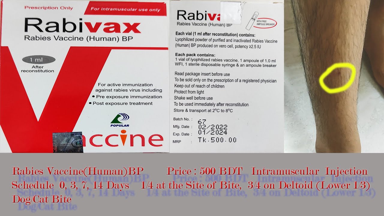 Intramuscular Injection Rabies How to inject Rabies Vaccine,কিভাবে কুকুর,বিড়াল কামড়ালে Rabies ...