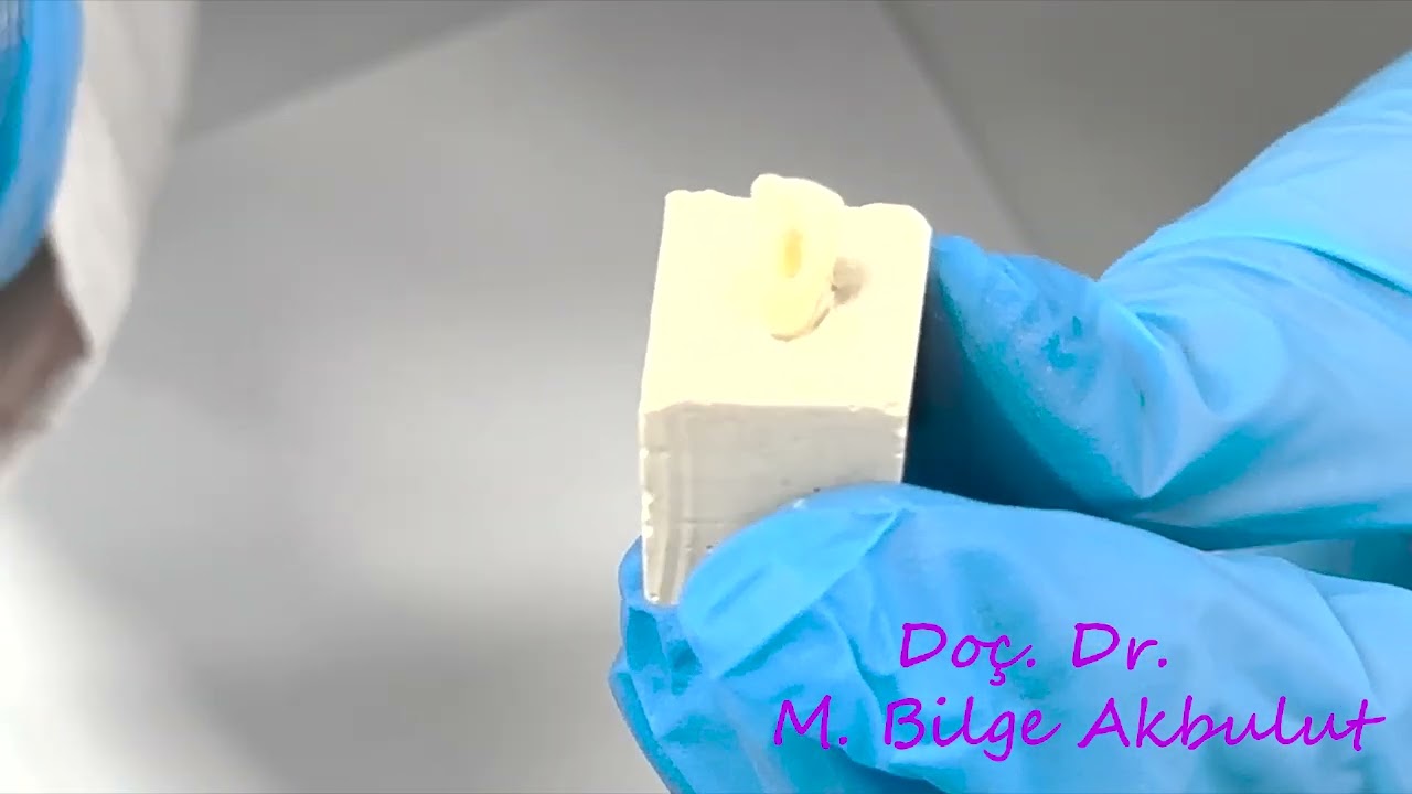 Endodontic Access Cavity Preparation on a Lower Incisor/ Alt keser dişte endodontik giriş kavitesi