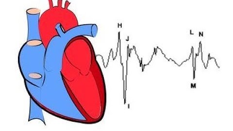 IICDC 2017 - Team  134496 - Quaterfinal Submission - Business Video