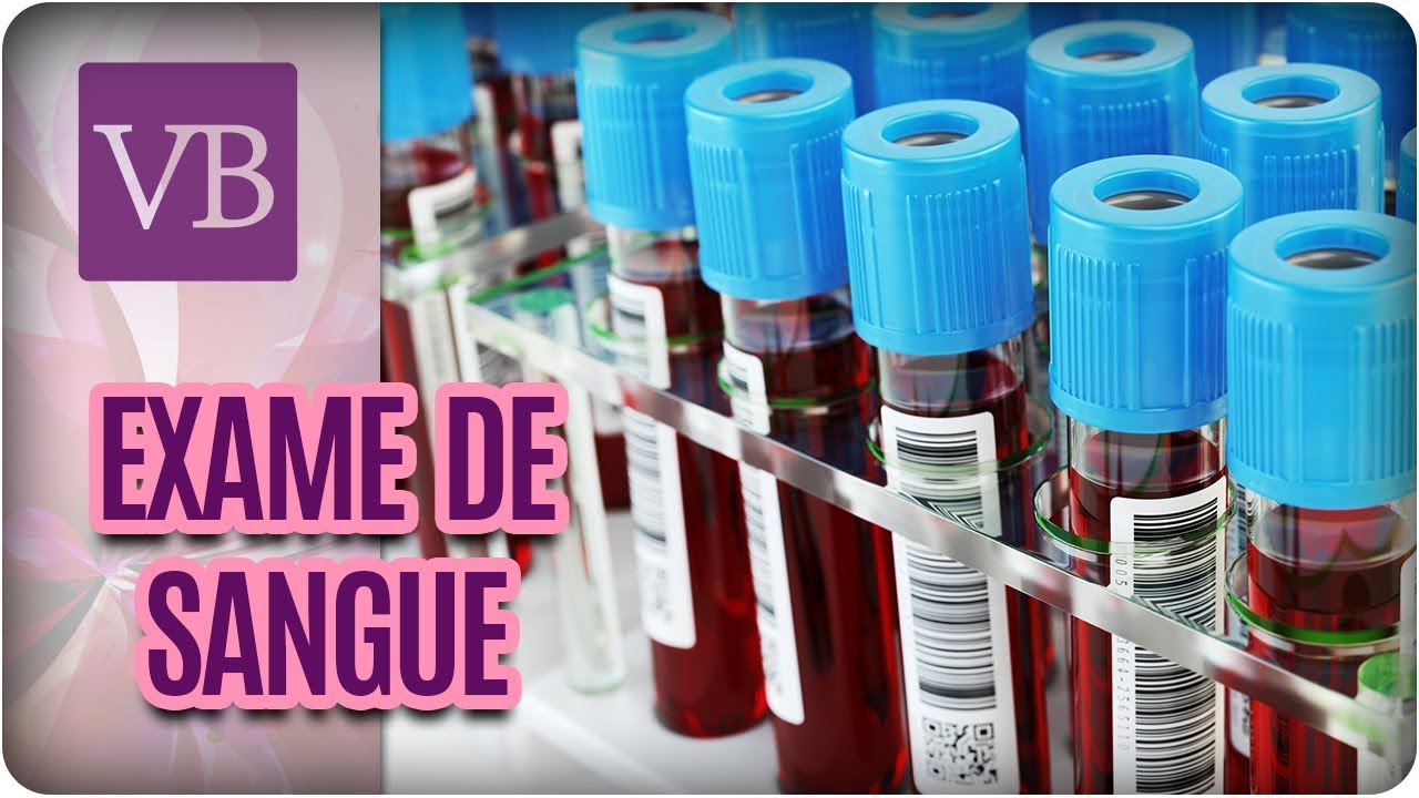Dúvidas Frequentes Sobre Exame de Sangue - Você Bonita (03/08/17) vida saudável herbalife