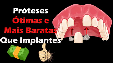 O que fazer para substituir um dente perdido?