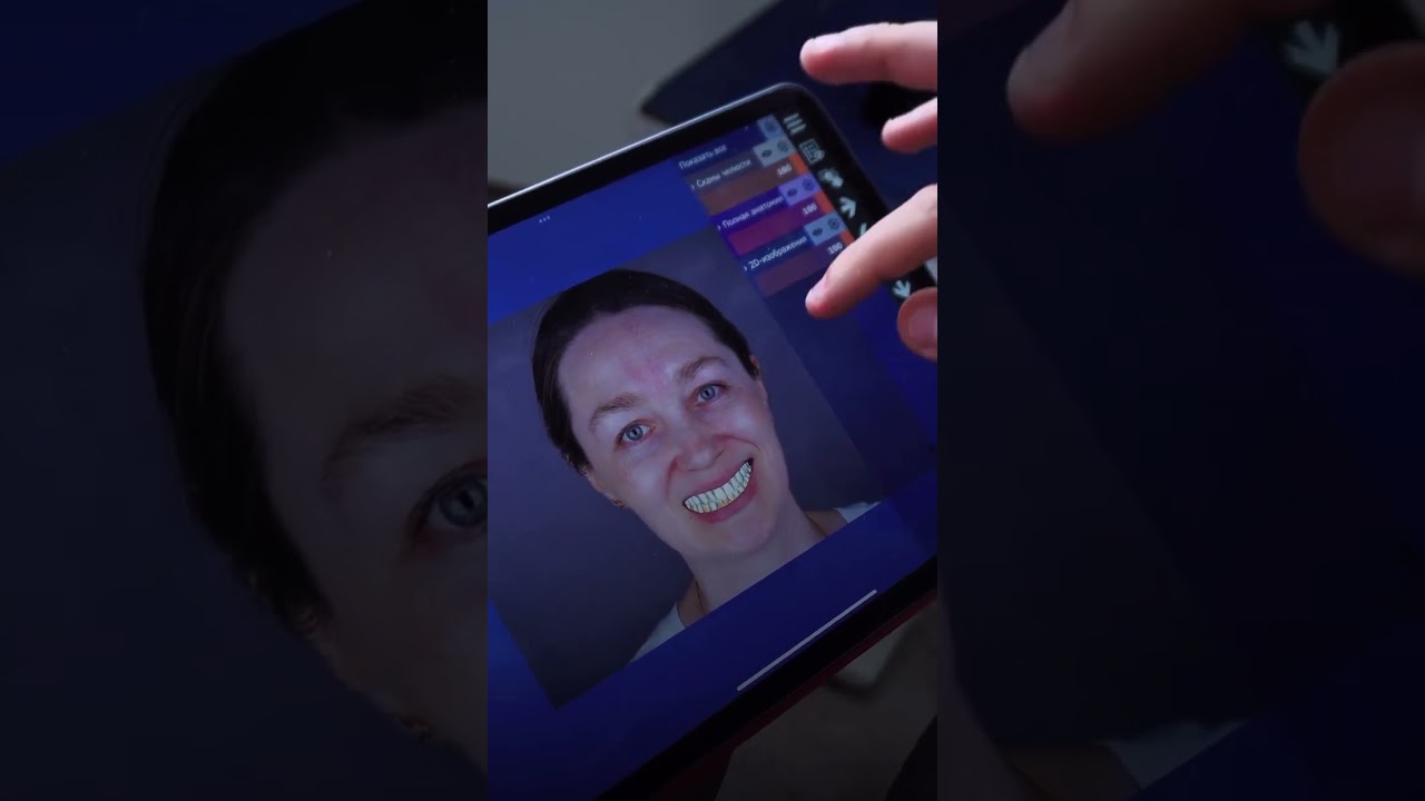 Незаменимая программа для врача - ортопеда 🔥#aikdent #стоматология #dentist