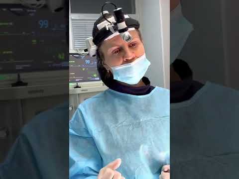 Video: Lina rinoplastika tulemus