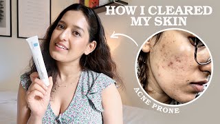 My 3 Step Evidence-Based Skincare Routine As A Doctor | HOW I CLEARED MY ACNE | Affordable, Easy..