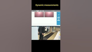 3DOE eWay2000 testing demonstration, measuring foot pressure distribution and other data