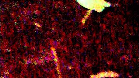 Stink Bug Break Dance