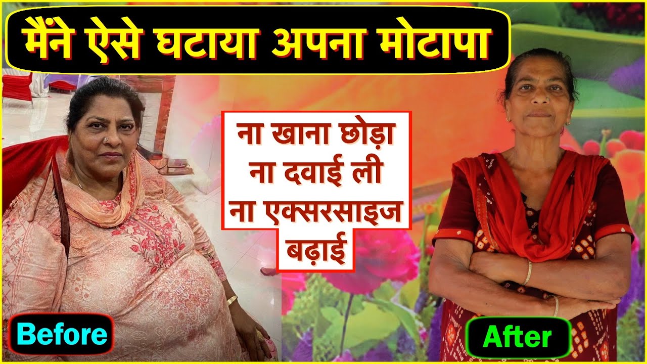मोटापा घटाने का कारगर तरीका, 100% कामयाब, ना खाना छोड़ना, ना दवाई लेनी Weight loss, fat loss
