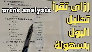 تعلم قراءة تحليل البول ومعرفة التشخيص بسهولة. urine analysis