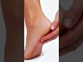Cracked Heels? Try This Simple Home Cream 👣✨