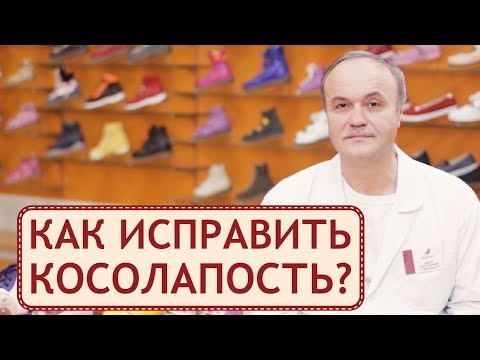 👟  Лечение косолапости с помощью ортопедической обуви. Косолапость лечение. Персей. 12+