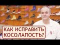 👟  Лечение косолапости с помощью ортопедической обуви. Косолапость лечение. Персей. 12+