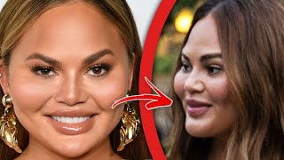 Top 10 Plastic Surgery Disasters That Celebrities Tried To Hide