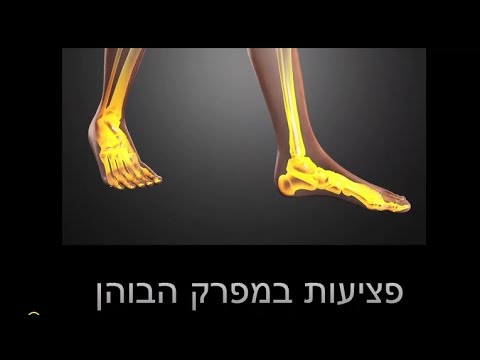 וִידֵאוֹ: מה המשמעות של הבוהן בתשחץ?