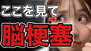 【目に異変】脳梗塞が近い人に起きる症状5選！