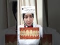 تسوس بعد الحمل و الرضاعه اكسبلور teeth اسنان تيك_توك mp3