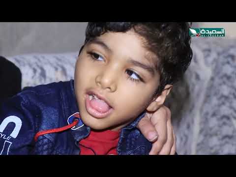 حالة إنسانية | الطفل أمجد عبدالله ذو السابعة ومعاناته من ظمور في الدماغ | سنابل الخير