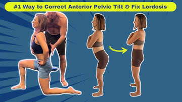 Top 3 Exercises to Correct Anterior Pelvic Tilt - Lordosis (GET RESULTS!)