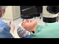 緊急で手術になりました【ICL手術】