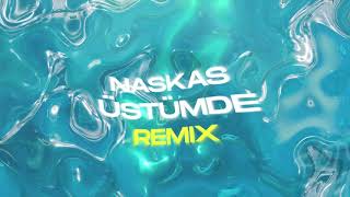 Naskas - Üstümde Remix (Remixed by Rexart) Resimi