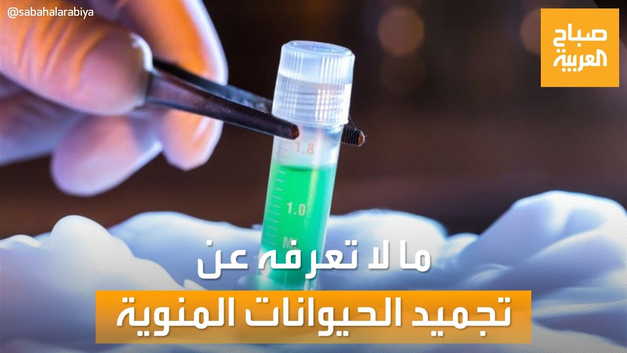 صباح العربية | معلومات قد لا تعرفها عن تجميد الحيوانات المنوية.. هل هي آمنة؟