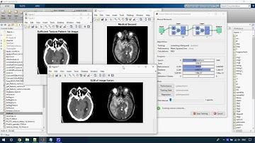 Medical Image Forgery Detection for Smart Healthcar