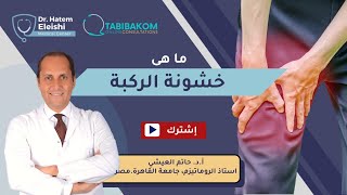 ما هى خشونة الركبة ؟.أ.د. حاتم العيشي