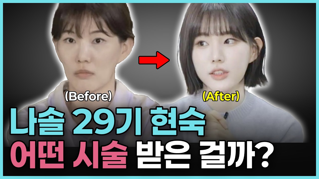 나는솔로 29기 현숙 시술 분석