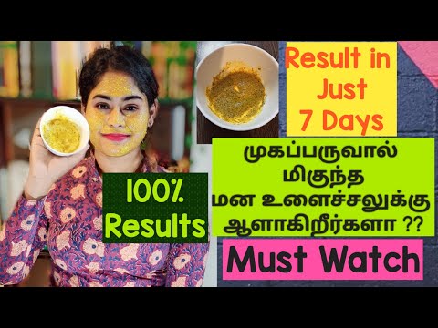 How to Get Rid of Pimple/ Acne in just 7 Days | 100% Result |3 Simple Ingredient