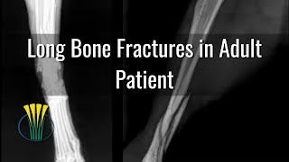 Mengatasi patah tulang panjang pada anjing dan kucing tanpa operasi.