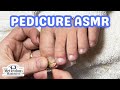 👣ASMR Pedicure Cleaning💆‍♀️Toenail Recovery Pedicure Tutorial👣