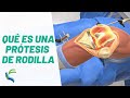 Que es una PROTESIS de RODILLA - Cirugia y Recuperacion | Fisiolution