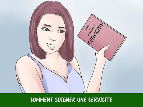 Vidéo: 3 façons d'identifier la cervicite