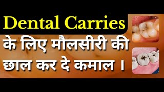 Dental Carries के लिए मौलसीरी की छाल कर दे कमाल । #viral #video #health #udupi #ayurved