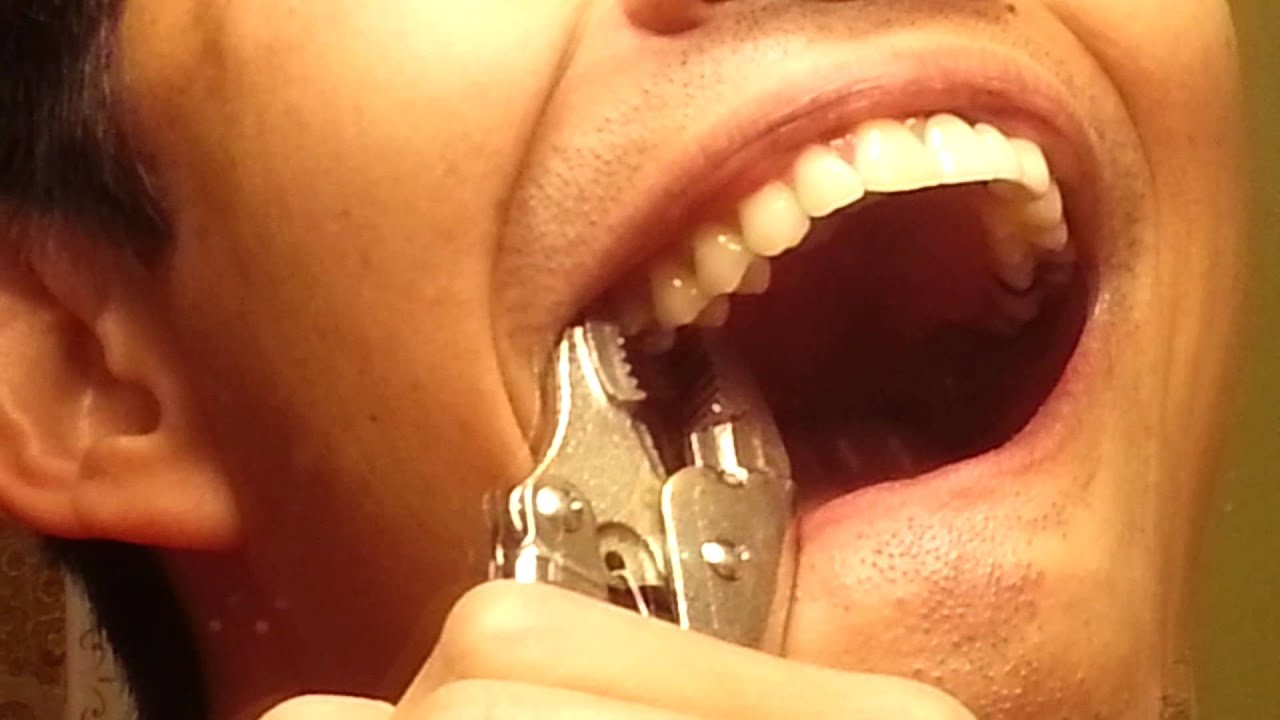 Pulled My Own Tooth Using Vise Grips YouTube Pulled My Own Tooth Using Vise Grips YouTube